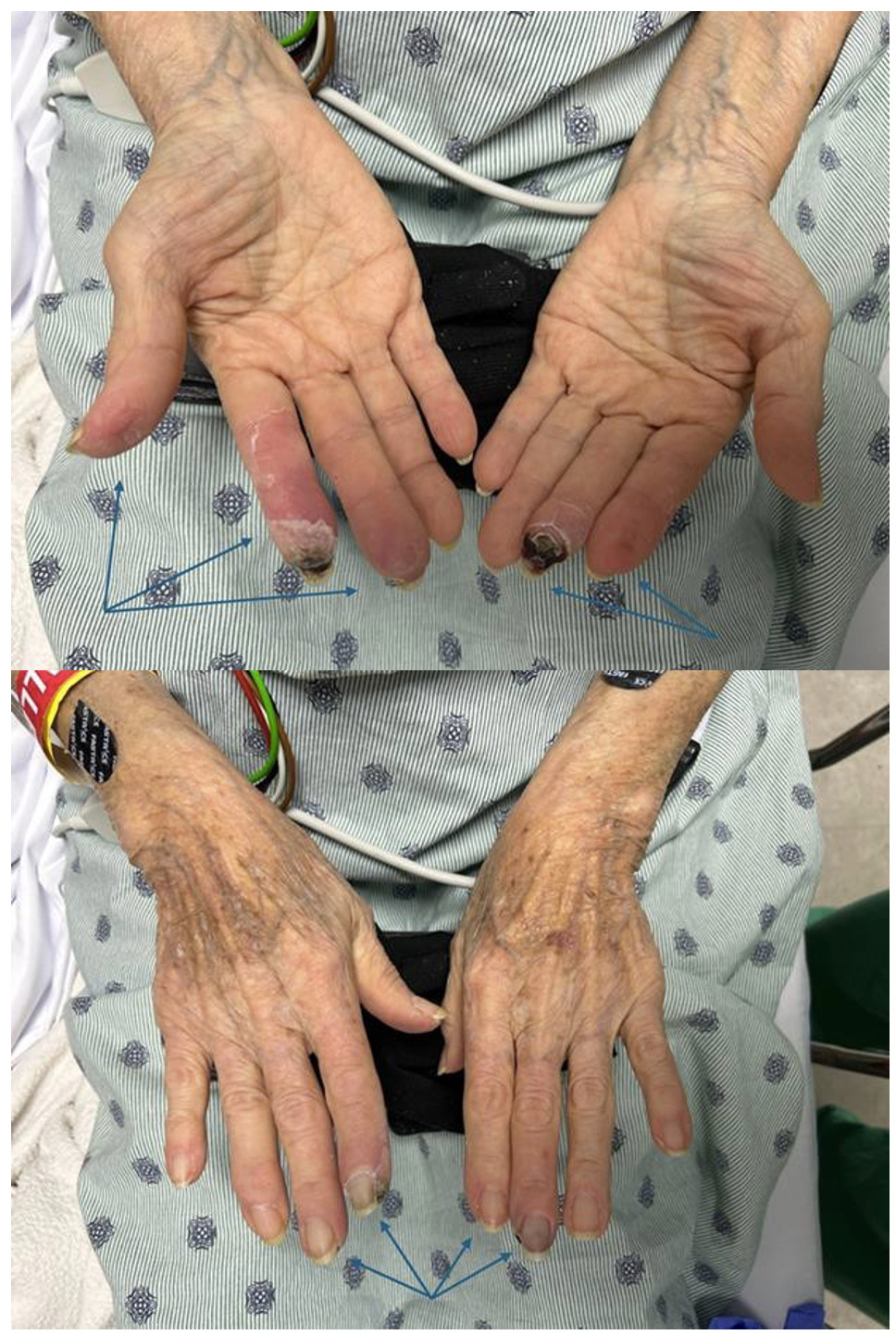 A close-up of a person's hands AI-generated content may be incorrect.
