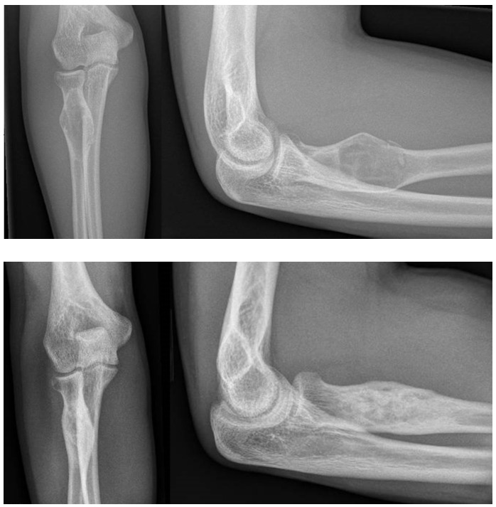 Close-up of a person's elbow AI-generated content may be incorrect.