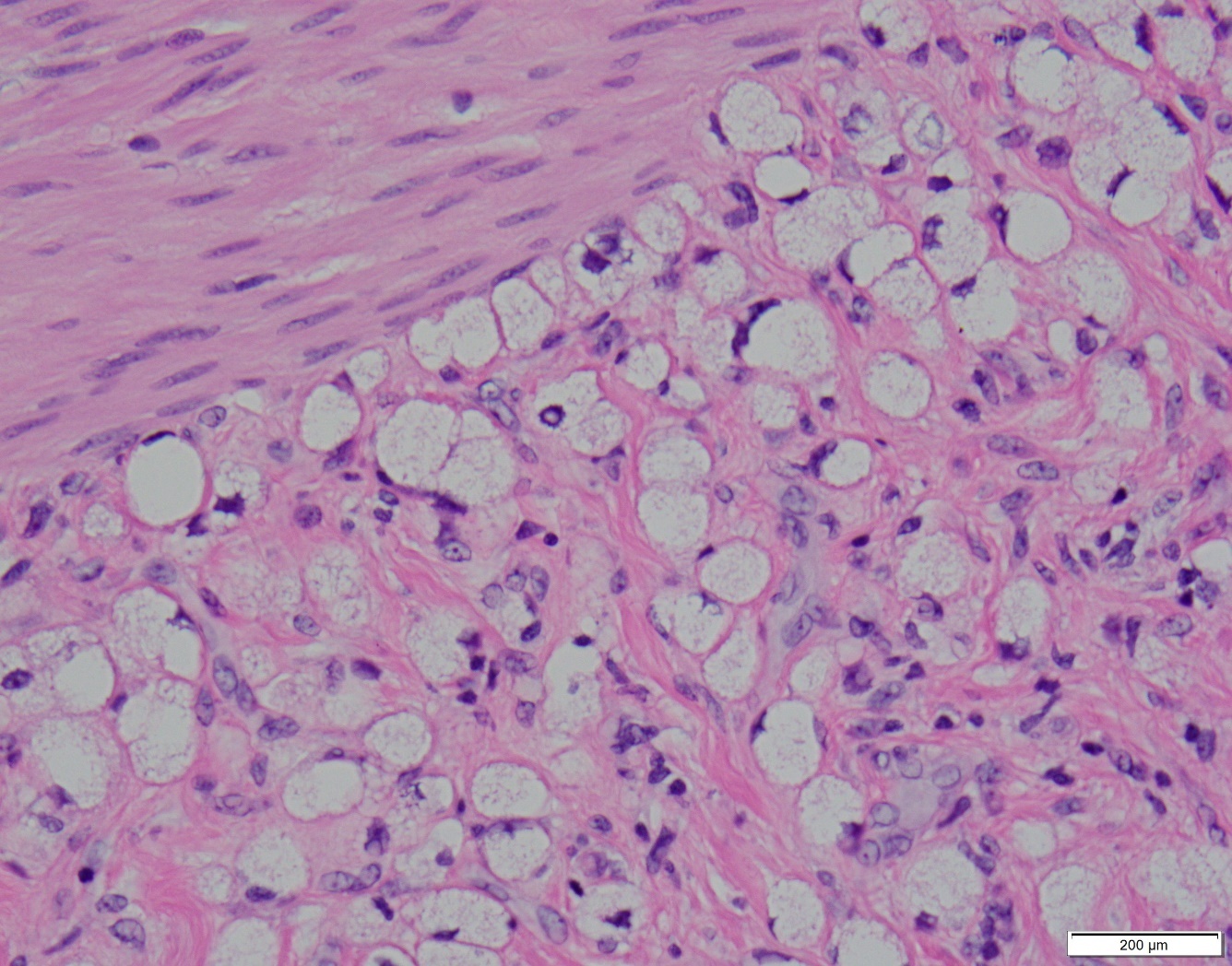 A close-up of a pink and white cell AI-generated content may be incorrect.