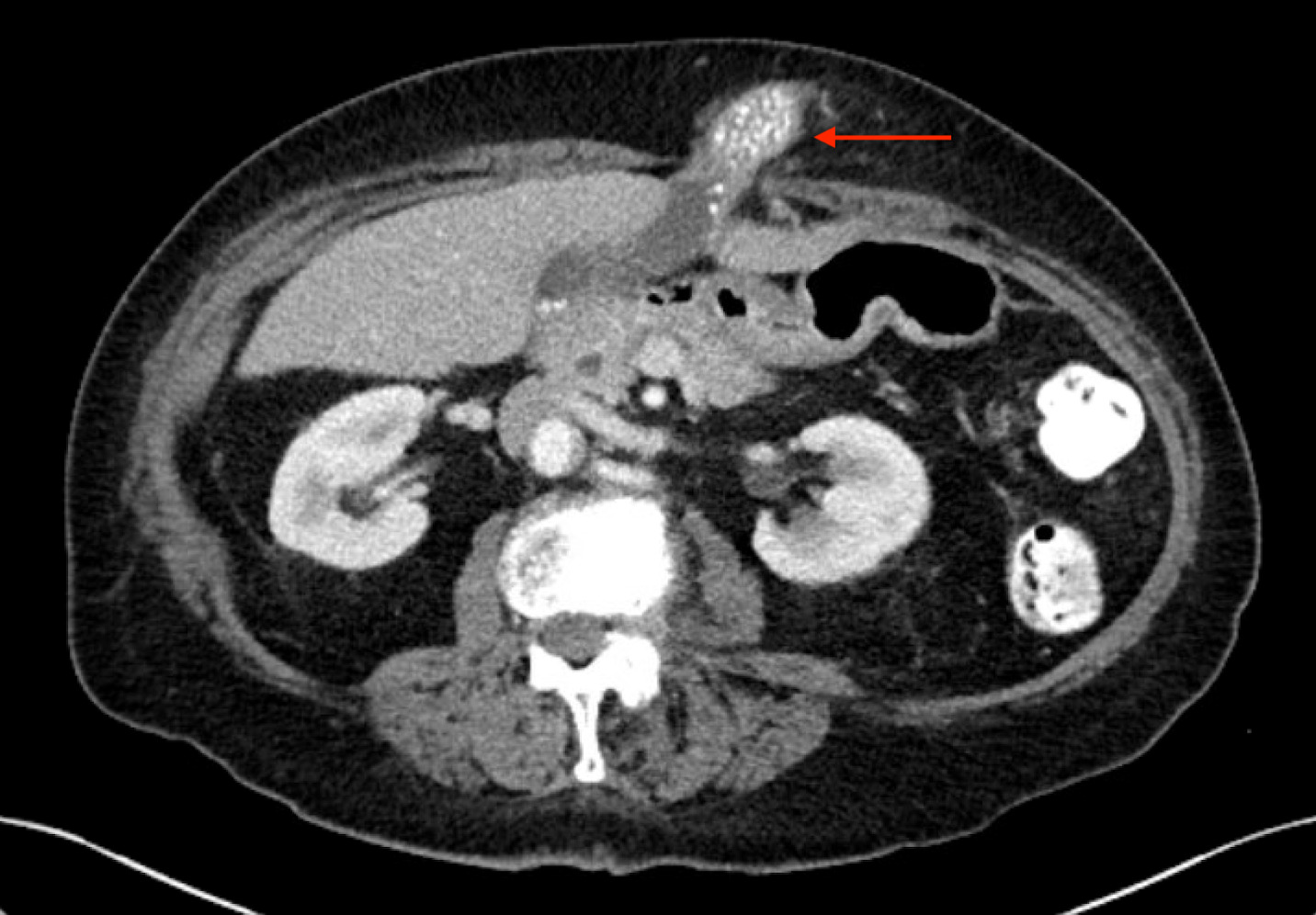 An x-ray of a person's body Description automatically generated