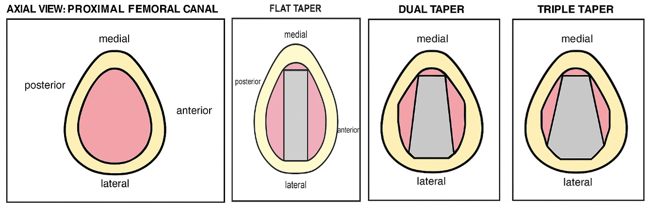 A diagram of different types of tapers AI-generated content may be incorrect.