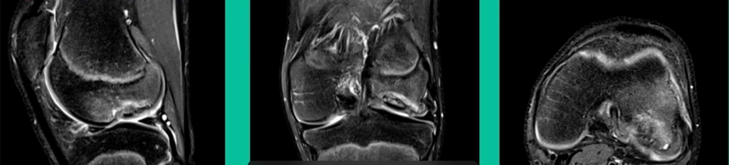 A close up of a face AI-generated content may be incorrect.