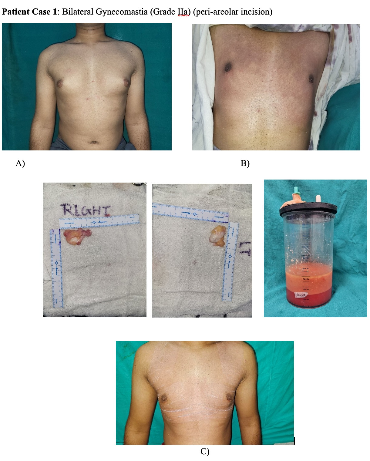 A collage of a person's chest AI-generated content may be incorrect.