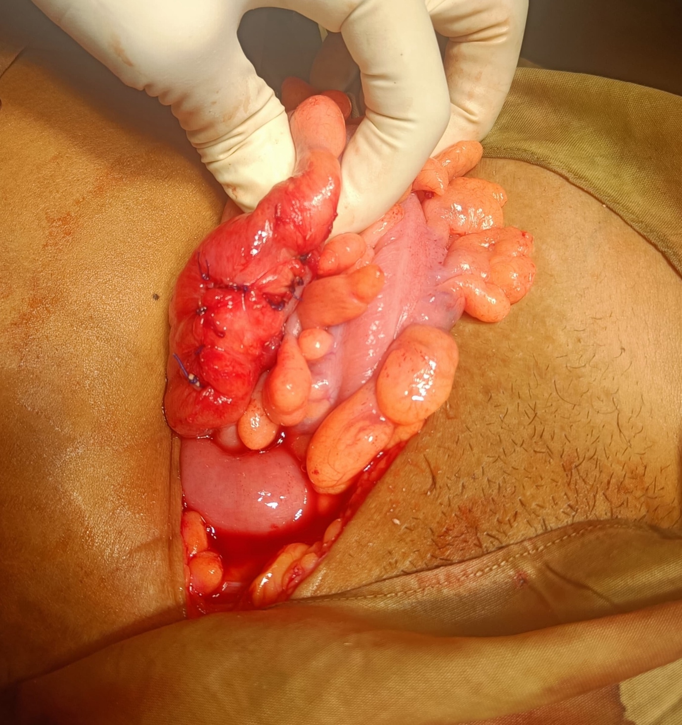 A person with a large intestine AI-generated content may be incorrect.