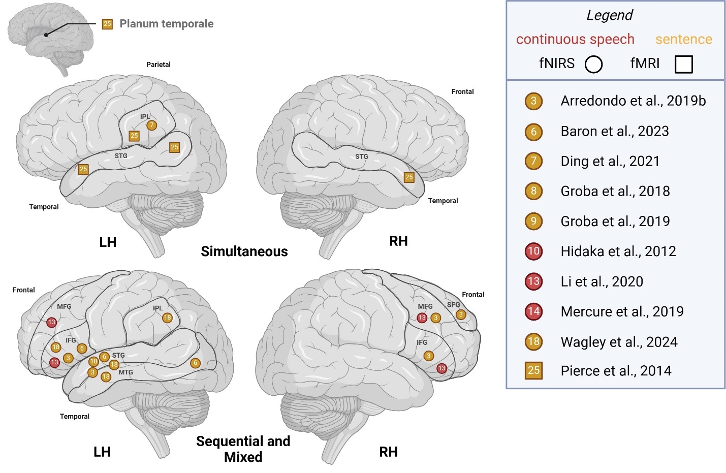 A diagram of the brain Description automatically generated