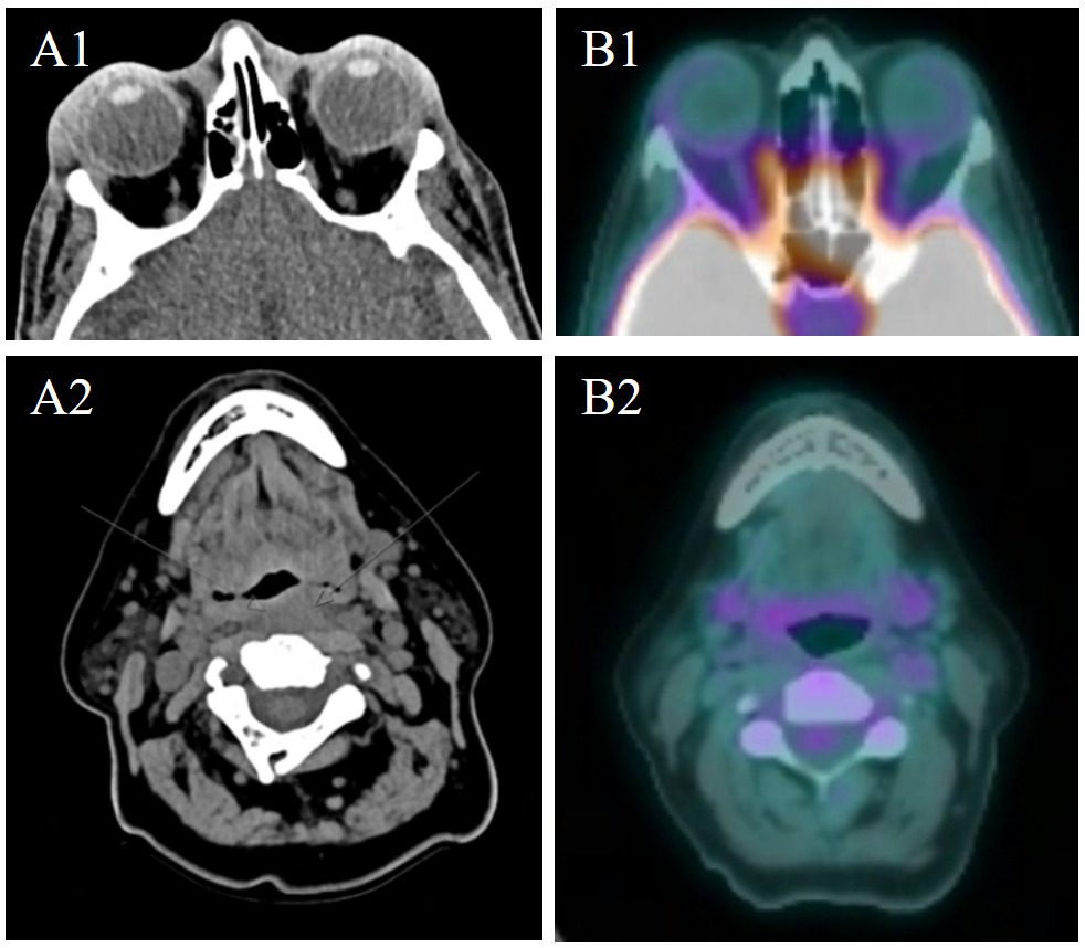 A close-up of a ct scan AI-generated content may be incorrect.