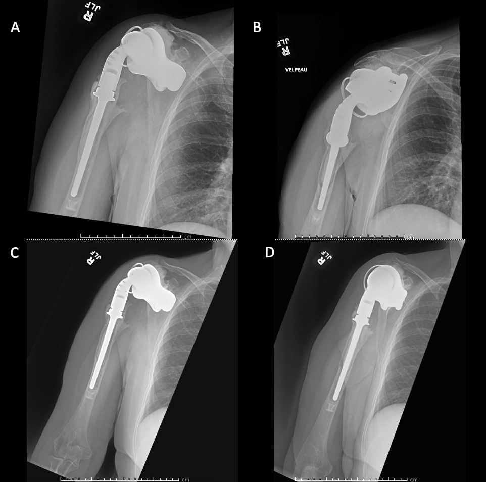 Figure 14