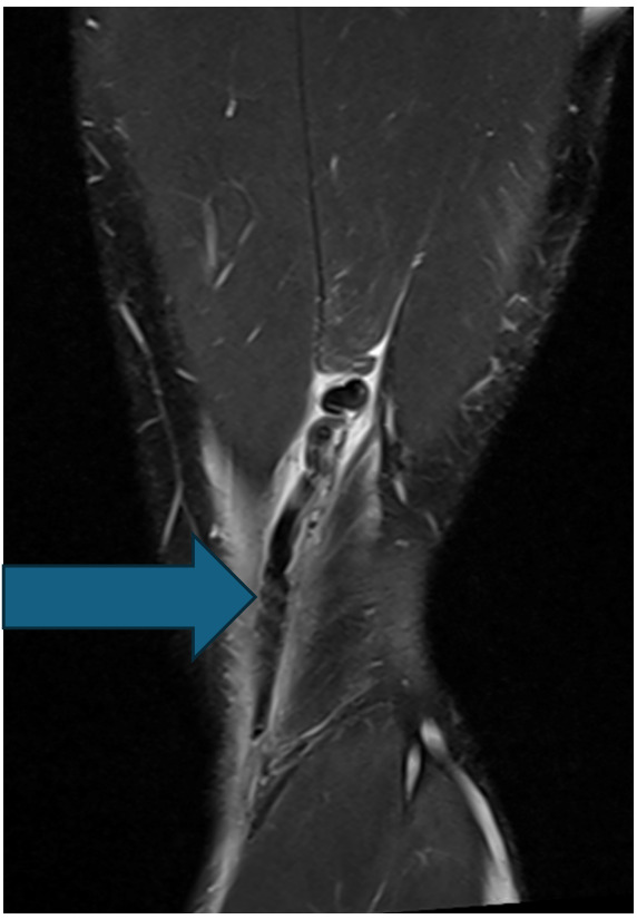 A screenshot of a computer AI-generated content may be incorrect.