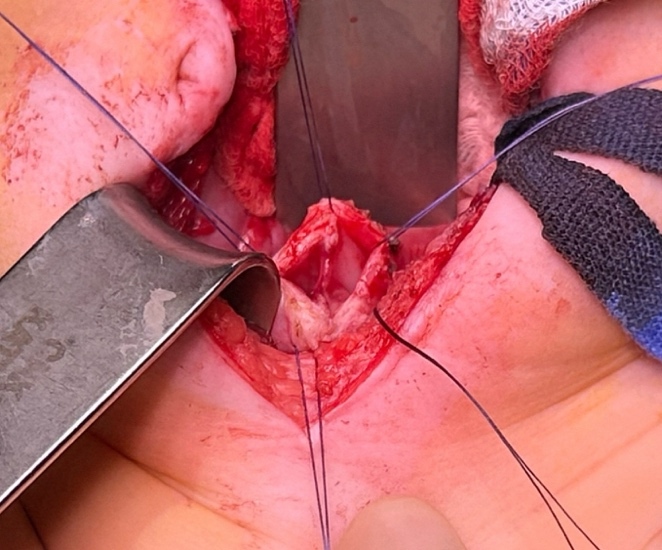 Une image contenant Chair, sang, blessure, outil Description générée automatiquement