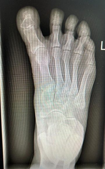 C:UsersdaniyOneDriveРабочий столИзображение р после(1).jpg