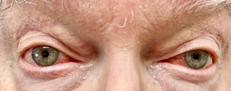 Close up of a person's eyes Description automatically generated