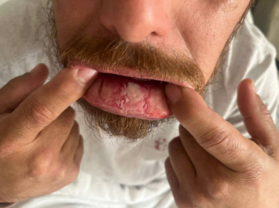 A person with a beard and tongue sticking out AI-generated content may be incorrect.