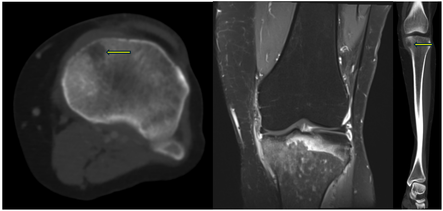 A mri scan of a human head AI-generated content may be incorrect.