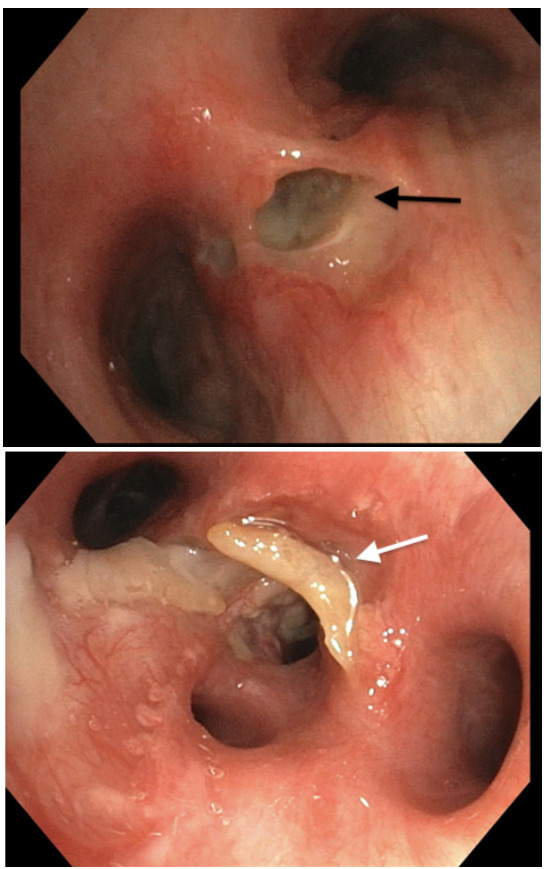 R 11.1 mm