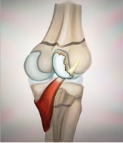 Afbeelding met kunst Door AI gegenereerde inhoud is mogelijk onjuist.