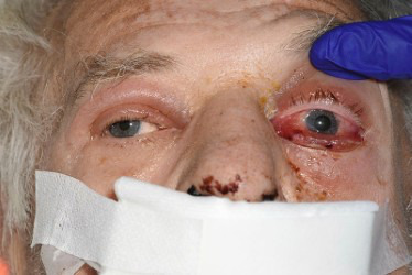 A close-up of a person's face Description automatically generated