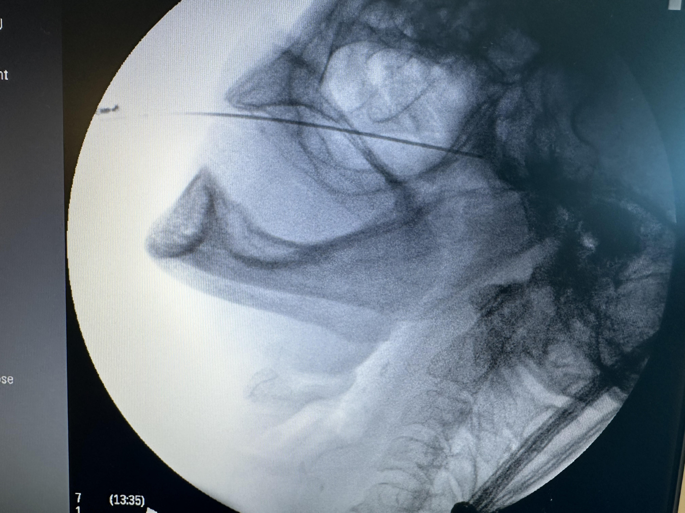 A close-up of a x-ray AI-generated content may be incorrect.