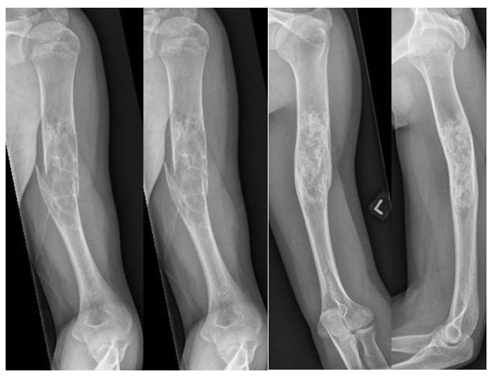 Close-up of a person's elbow AI-generated content may be incorrect.