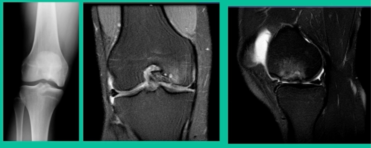 Close-up of a knee scan AI-generated content may be incorrect.