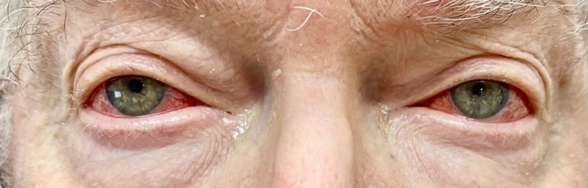 Close up of an old person's eyes Description automatically generated