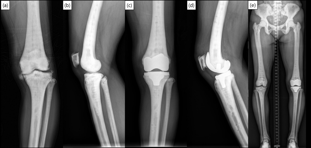 figure_4.