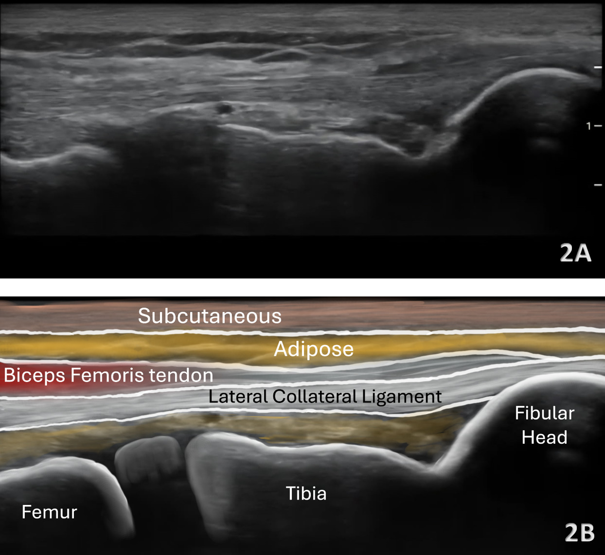 A close-up of a medical scan AI-generated content may be incorrect.