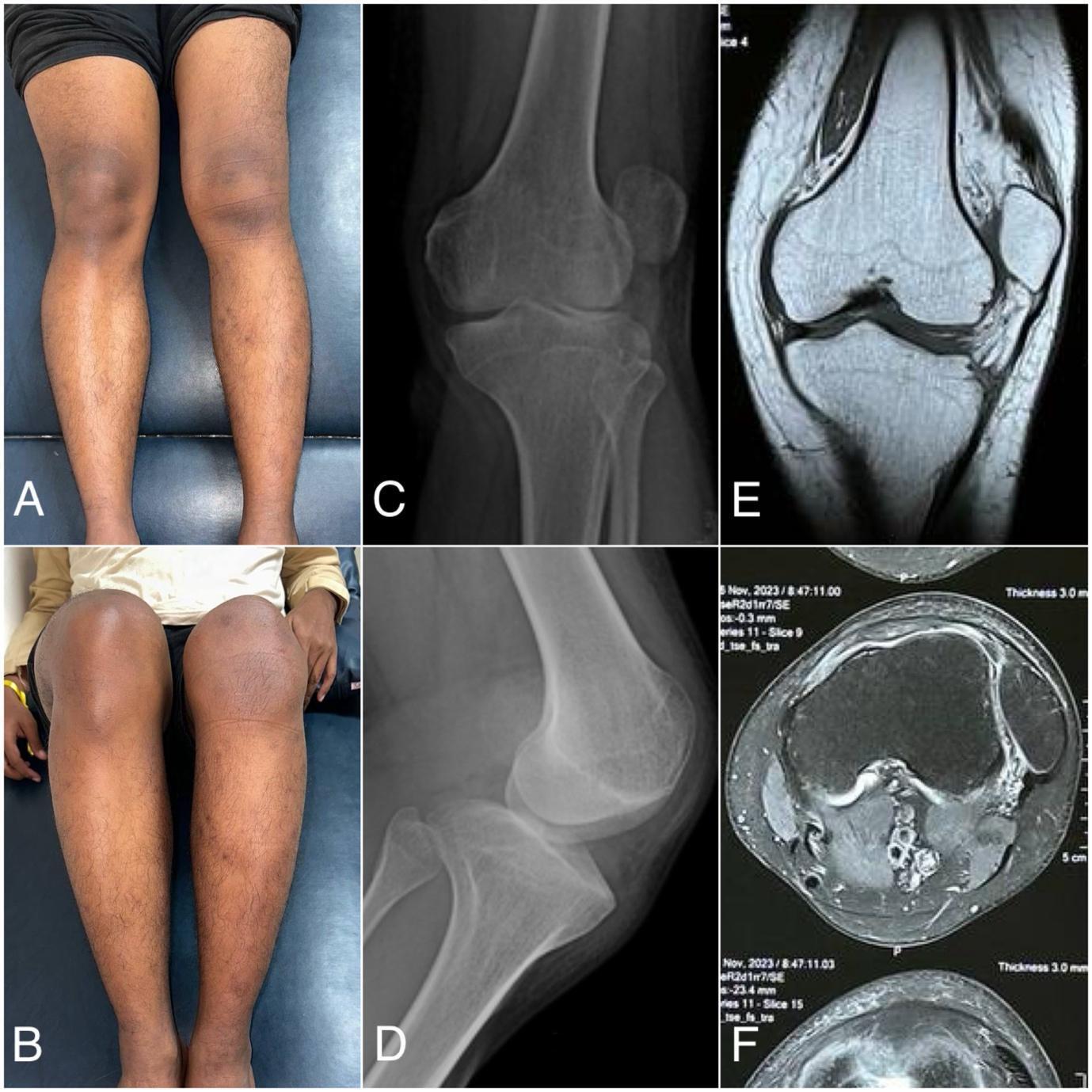 A collage of images of a person's legs Description automatically generated