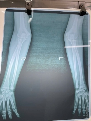 Ảnh có chứa phim x quang, Hình ảnh y khoa, Tia X, chụp X quang Nội dung do AI tạo ra có thể không chính xác.