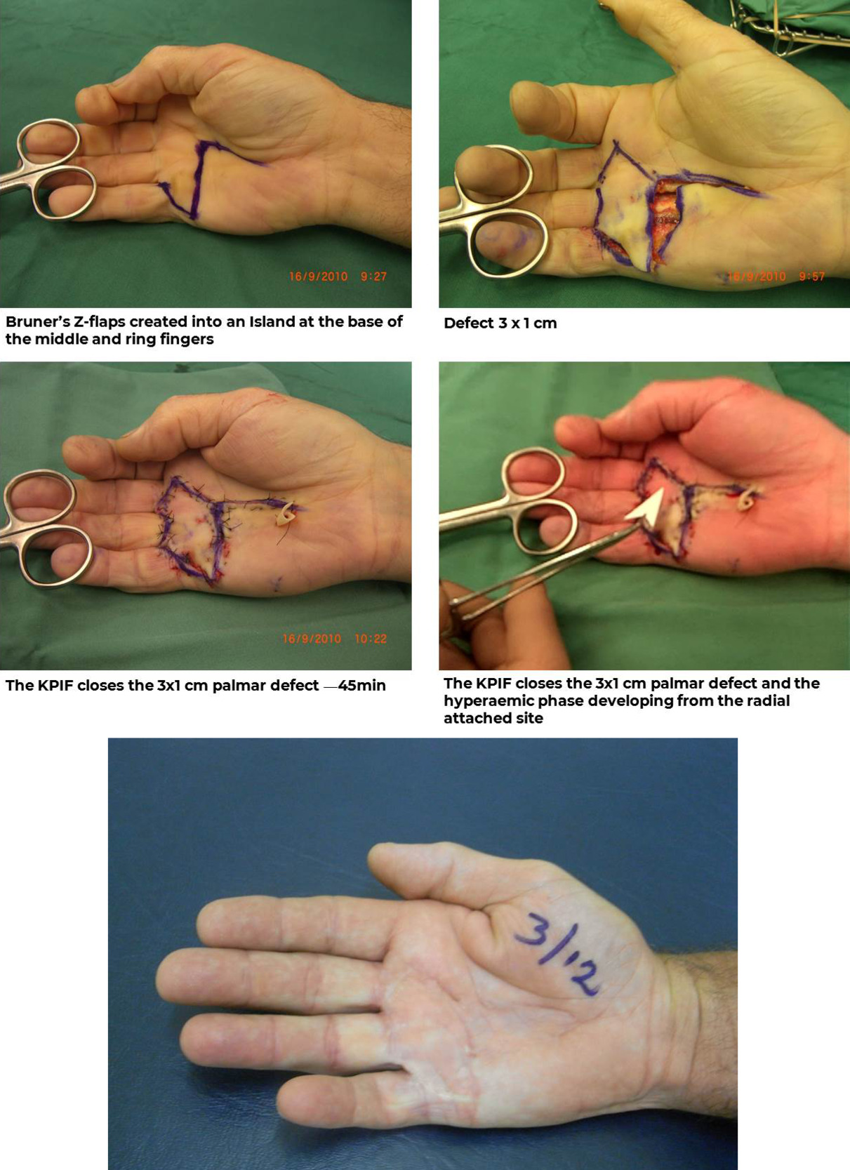 Case 6