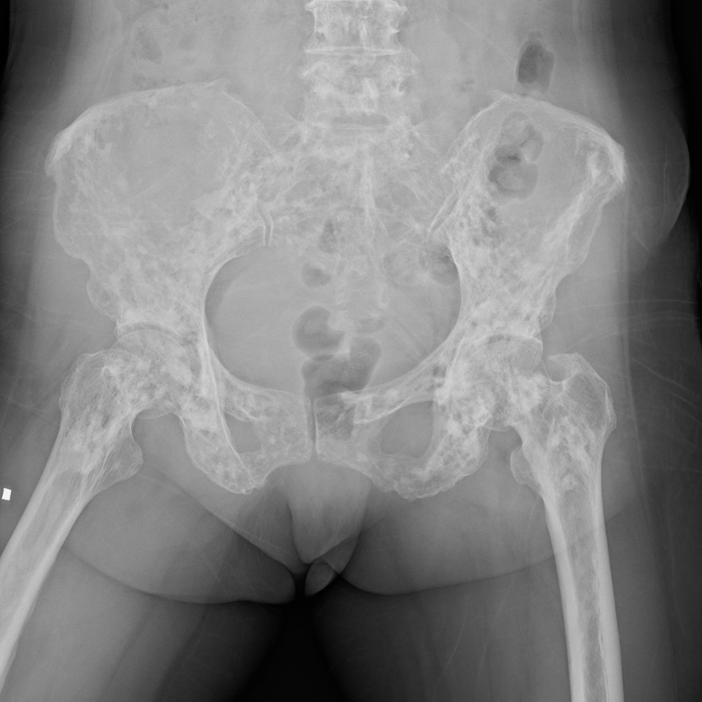 X-ray of a person's body AI-generated content may be incorrect.
