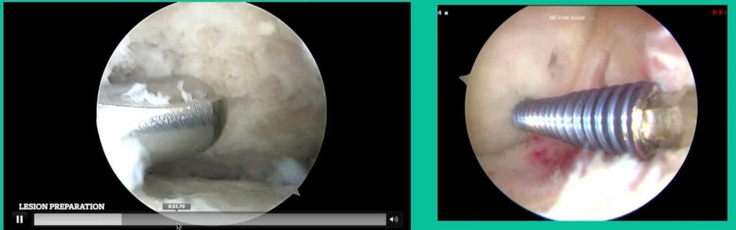 A screenshot of a video AI-generated content may be incorrect.