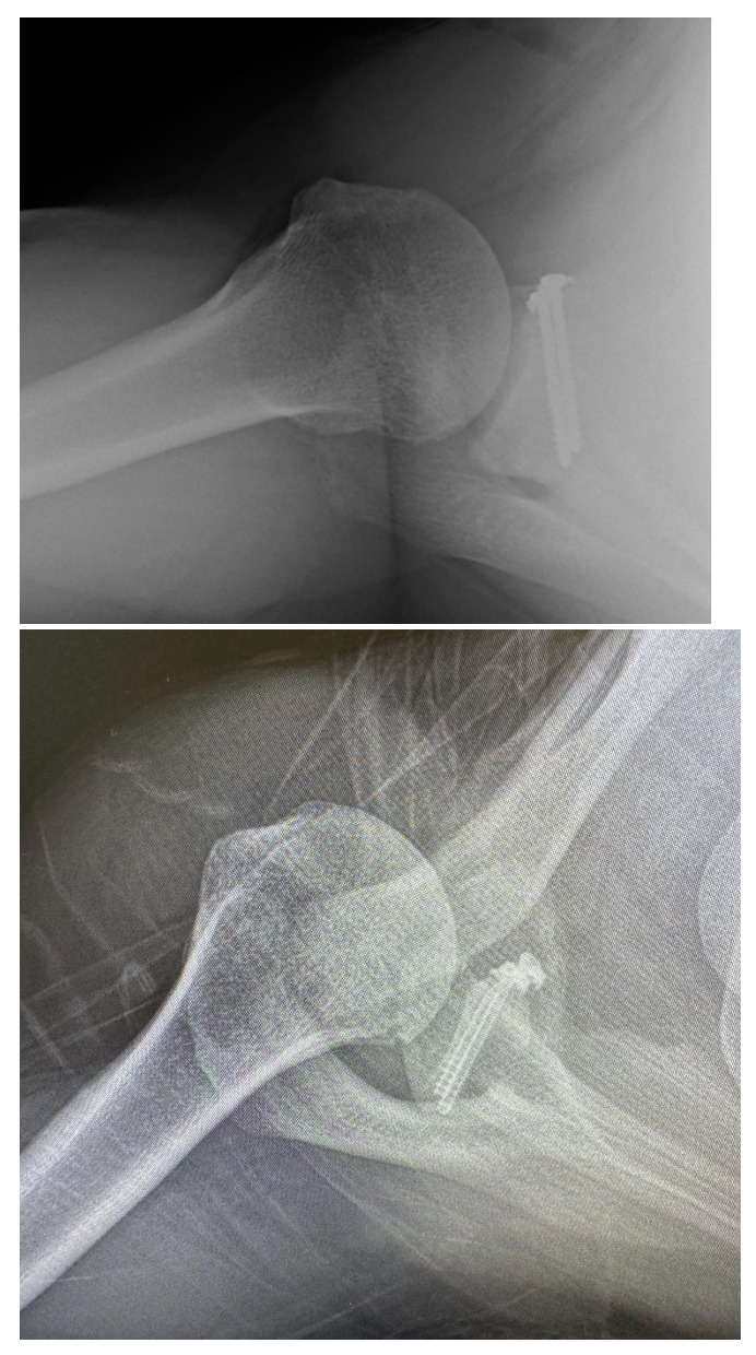 Figure 2a and 2b
