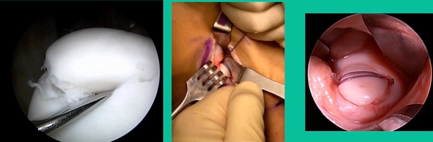 Close-up of a person's body AI-generated content may be incorrect.