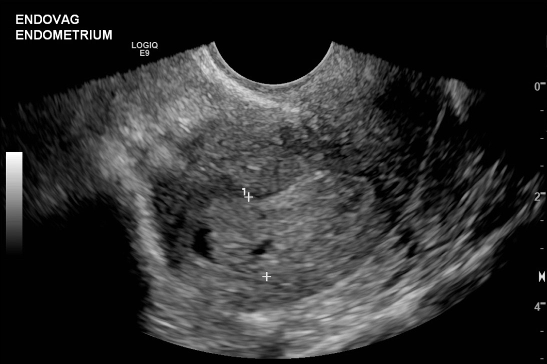 Figure 2A