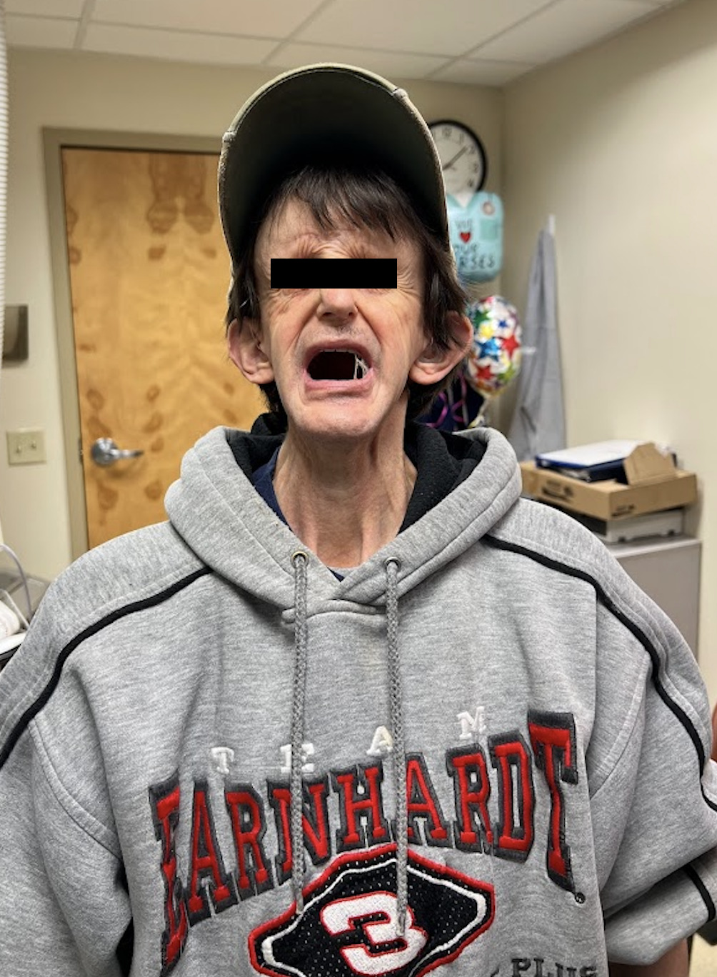 A person with a black eye and mouth open AI-generated content may be incorrect.