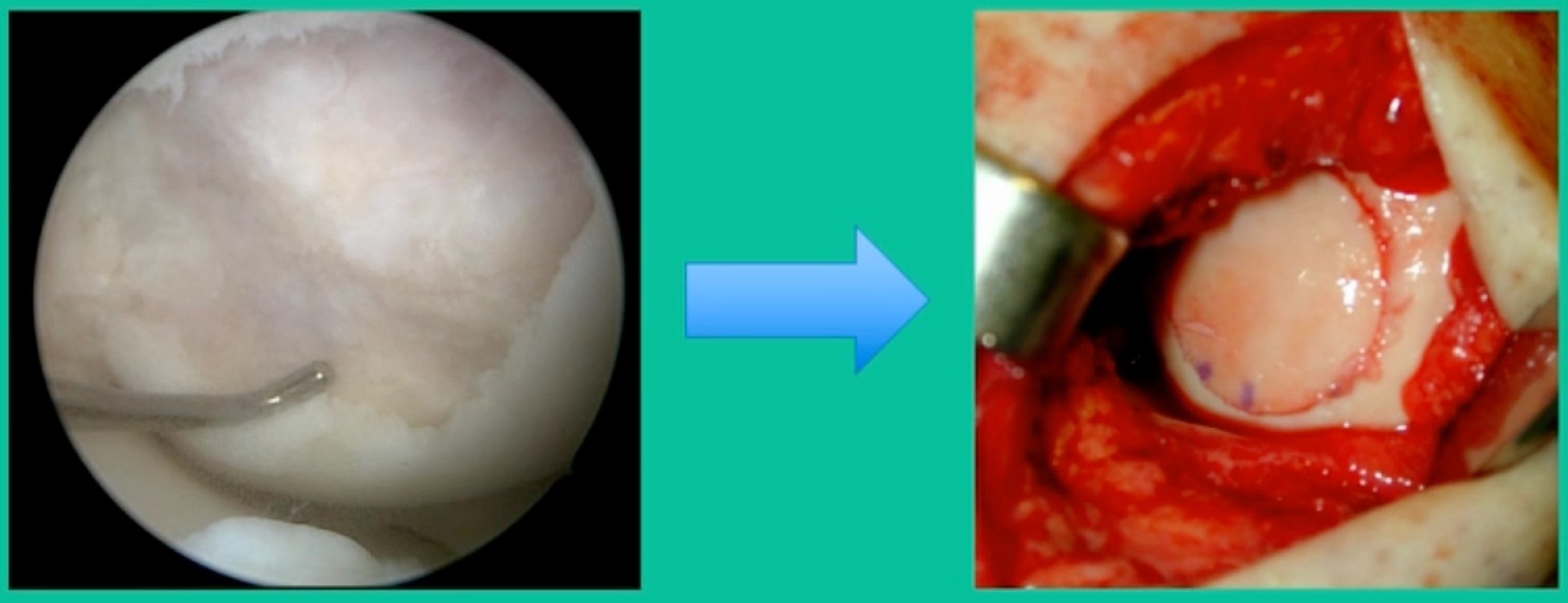 A close-up of a person's teeth AI-generated content may be incorrect.