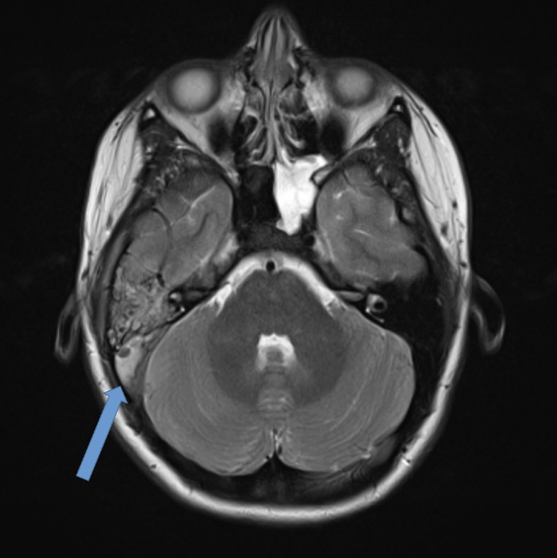 A mri of the brain AI-generated content may be incorrect.