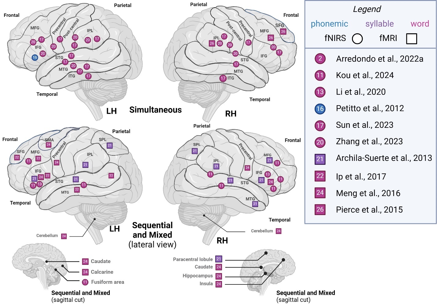A diagram of the brain Description automatically generated