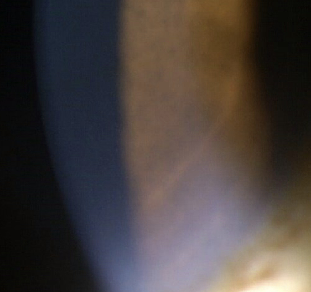 A close-up of a light AI-generated content may be incorrect.