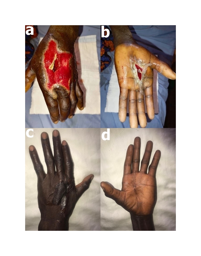 Figure 2