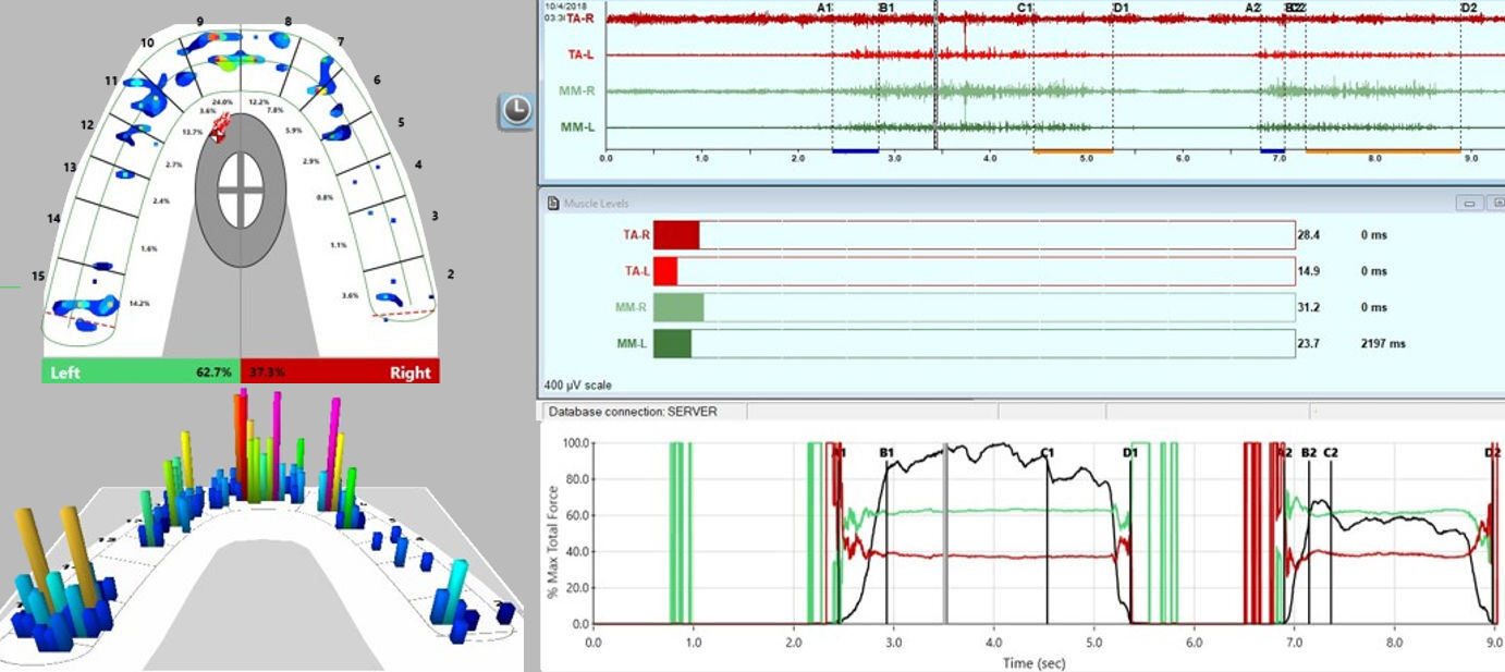 Figure 14