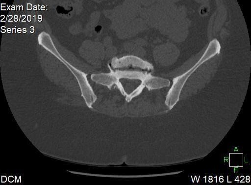 Figure 45