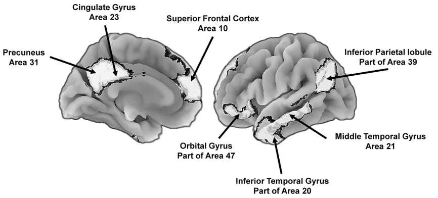 A close-up of the brain AI-generated content may be incorrect.