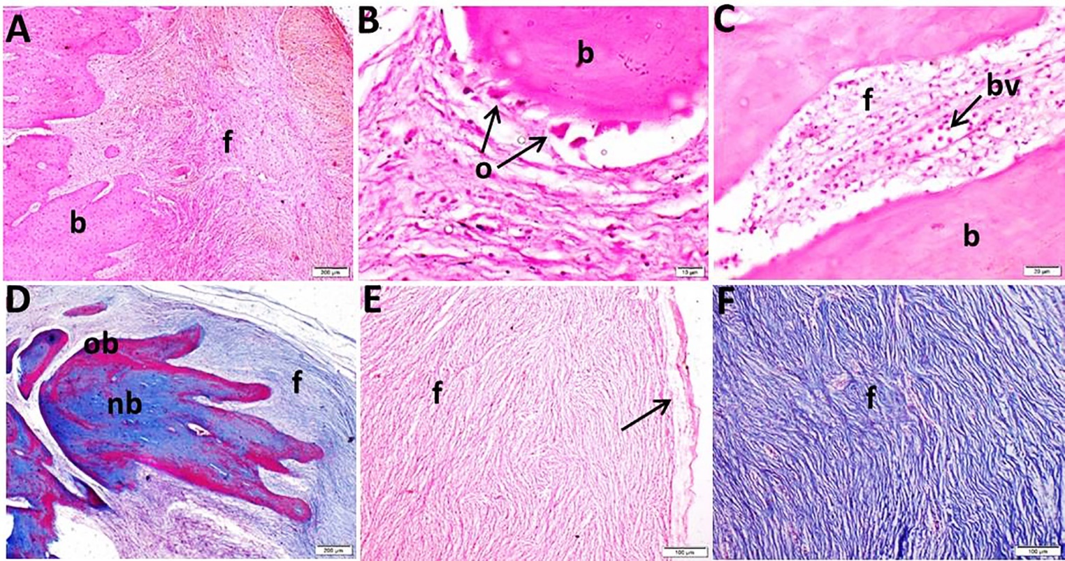 D:Not copiedResearch and projecsشغل د. مصطفى أخر كلامأبحاث الأورامأبحاث منتهيهFibroma and Fibroosteomaالبحث نهائى بعد ضم كل الأنواعSubmission to JournalsSubmission to EAFP. Major revisionAuthor reply on reviewer commentscorrected photosP4.jpg