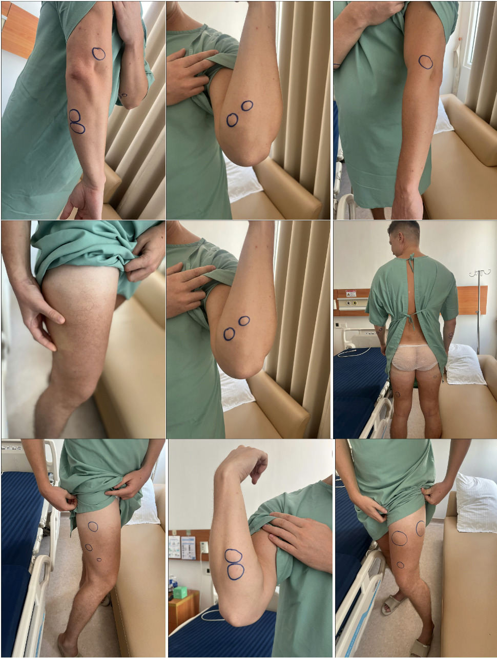 A collage of a person in a hospital gown Description automatically generated