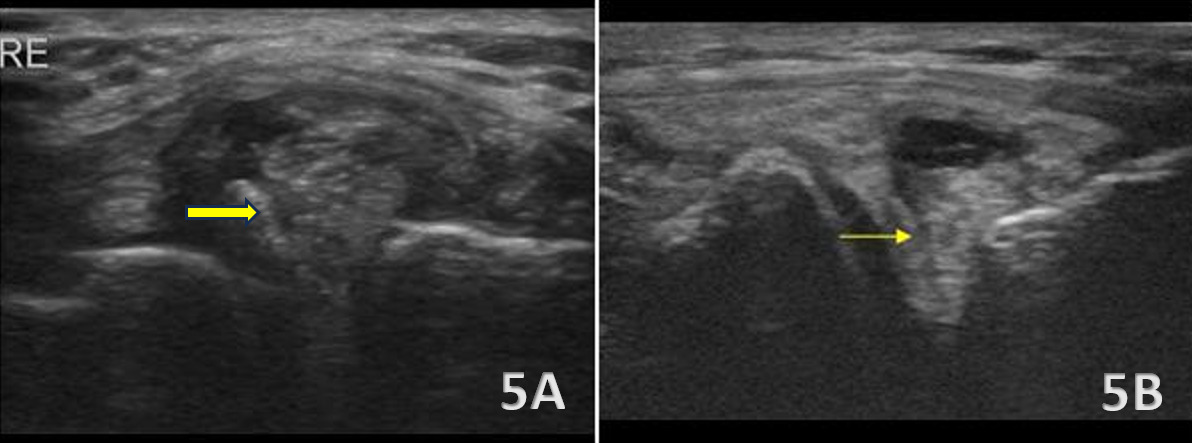 A close-up of a ultrasound AI-generated content may be incorrect.