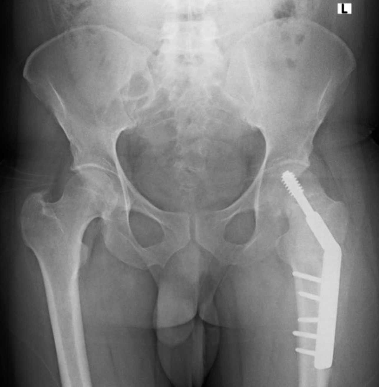 Figure 4