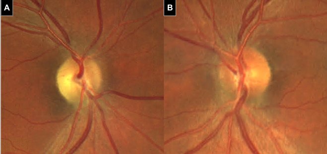 A close-up of a microscope AI-generated content may be incorrect.