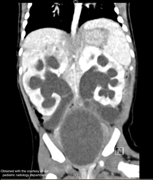 Une image contenant film radiographique, Imagerie médicale, radiologie, radiographie Description générée automatiquement