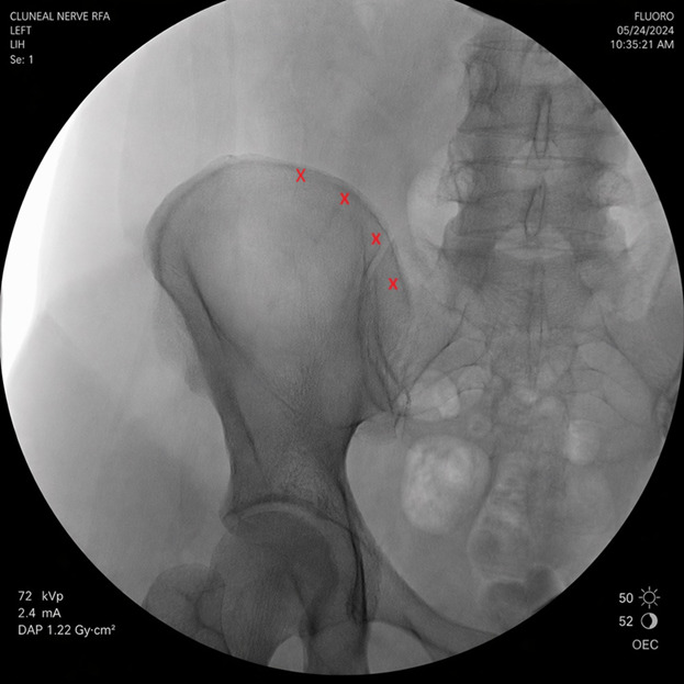 Figure 2